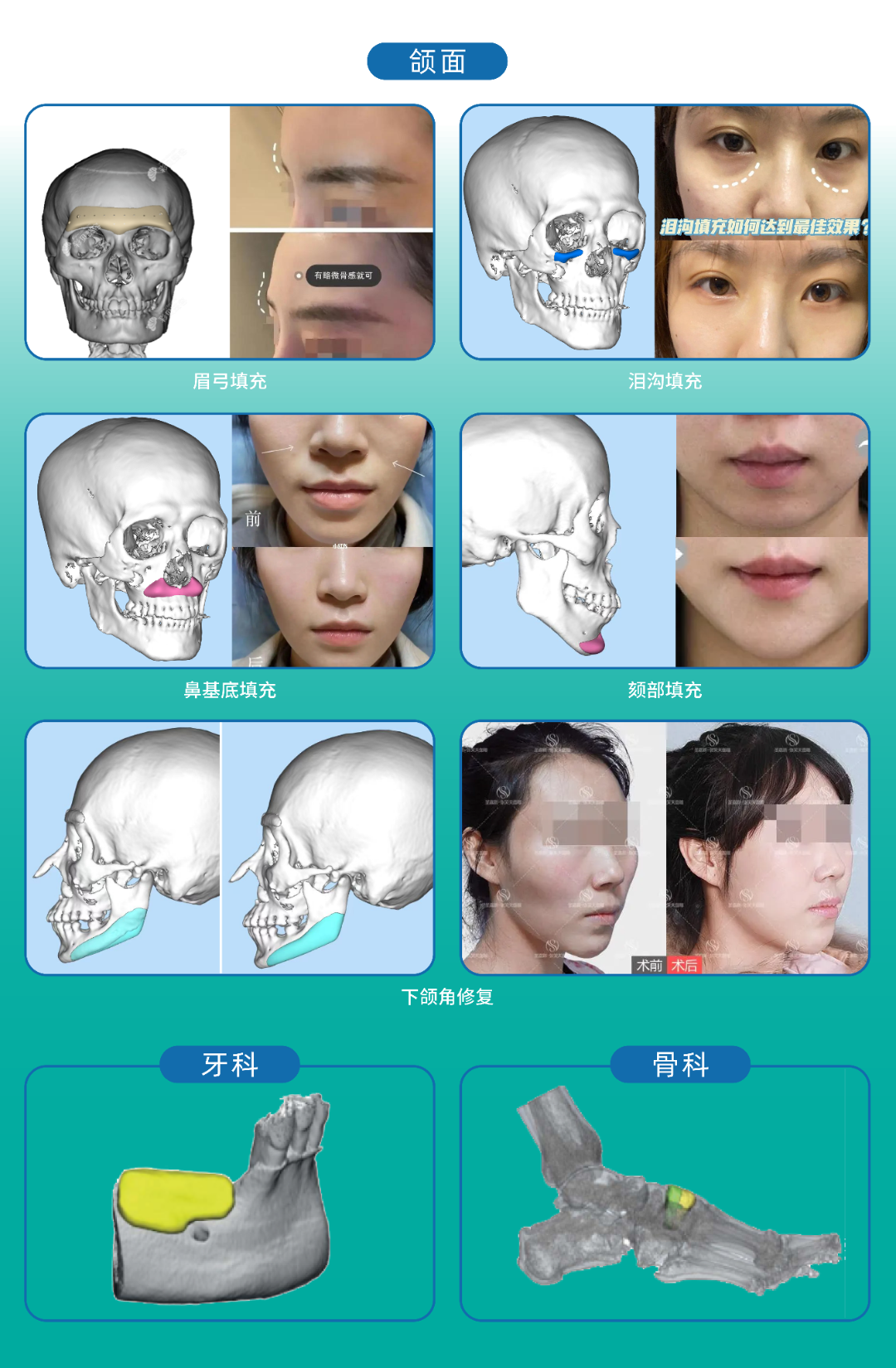 消博会6.png