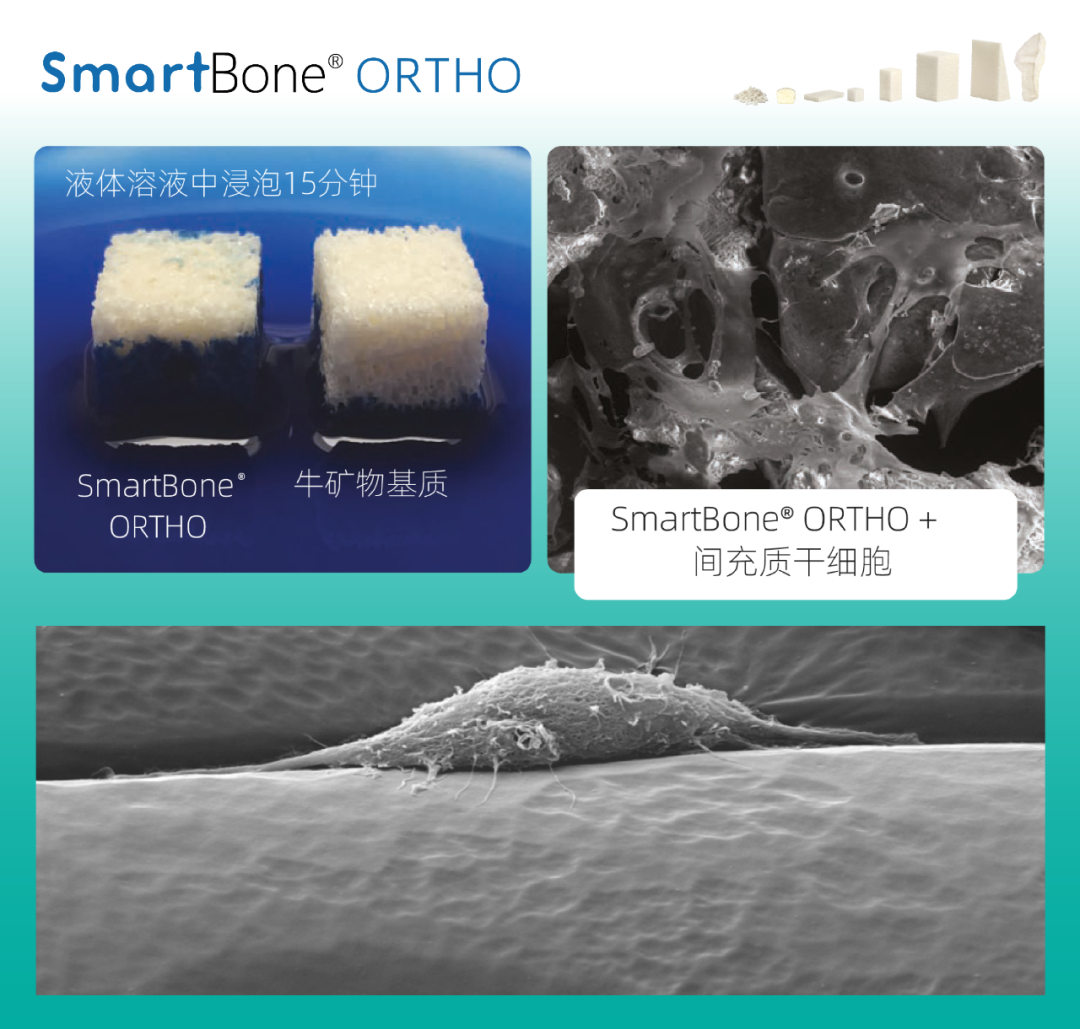 未来已来!瑞士“聚酯胶原骨修复材料”国内获批上市! - 海南苏生生物科技有限公司